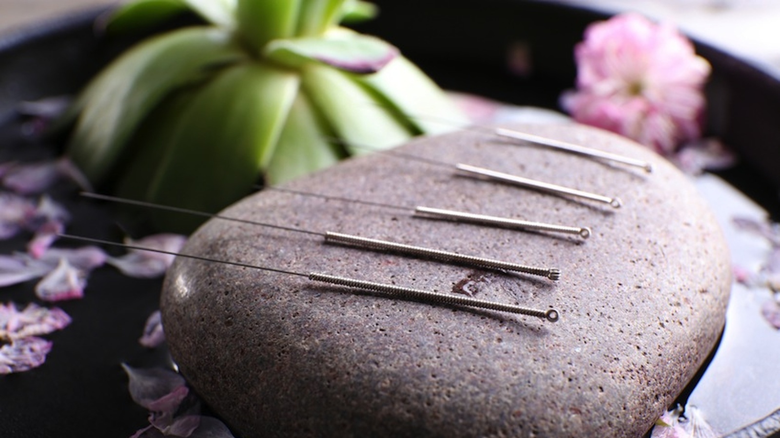 5 Ways Acupuncture Can Compliment Your Lifestyle